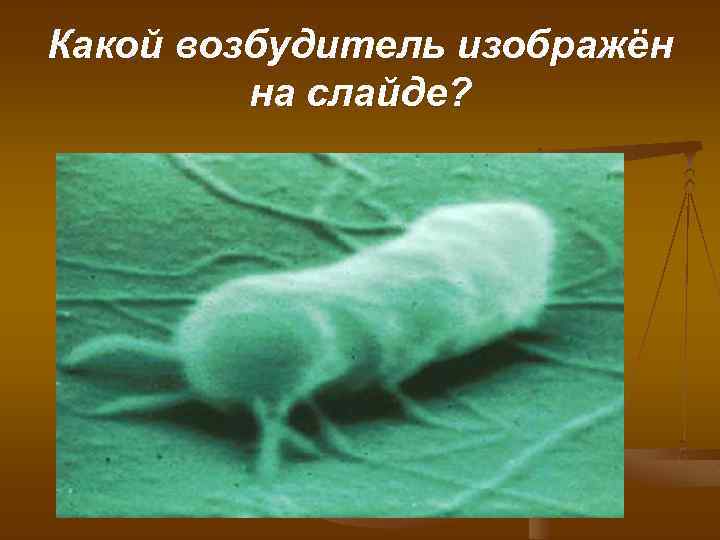 Какой возбудитель изображён на слайде? 