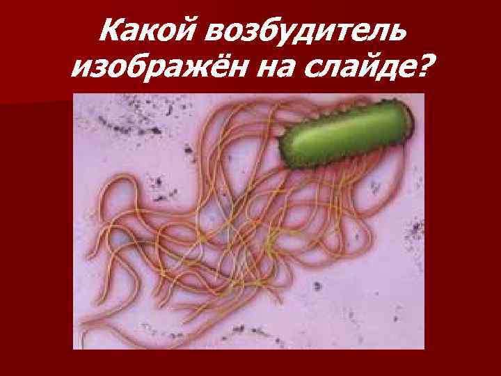 Какой возбудитель изображён на слайде? 
