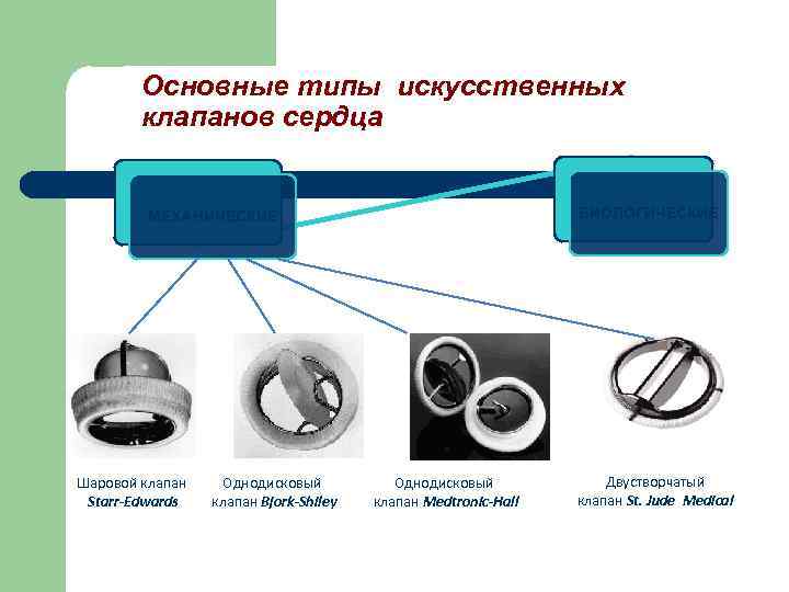 Виды искусственных клапанов сердца