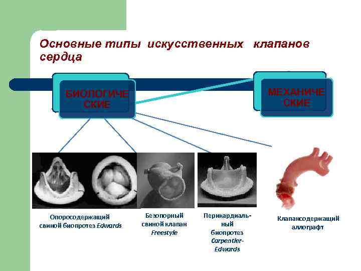 Основные типы искусственных клапанов сердца МЕХАНИЧЕ СКИЕ БИОЛОГИЧЕ СКИЕ Опоросодержащий свиной биопротез Edwards Безопорный