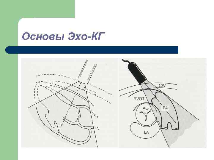 Основы Эхо-КГ 