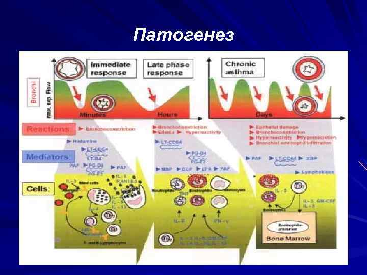 Профессиональная бронхиальная астма презентация