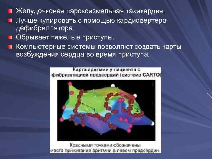 Желудочковая пароксизмальная тахикардия. Лучше купировать с помощью кардиовертерадефибриллятора. Обрывает тяжелые приступы. Компьютерные системы позволяют