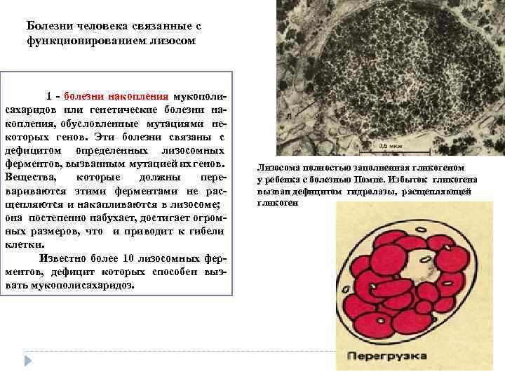 Болезни человека связанные с функционированием лизосом 1 болезни накопления мукополи сахаридов или генетические болезни