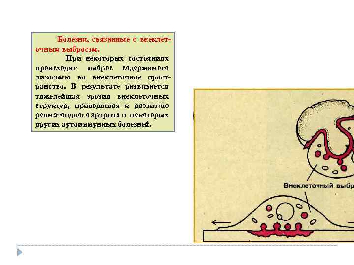  Болезни, связанные с внеклет очным выбросом. При некоторых состояниях происходит выброс содержимого лизосомы