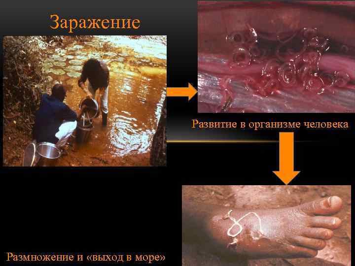 Заражение Развитие в организме человека Размножение и «выход в море» 