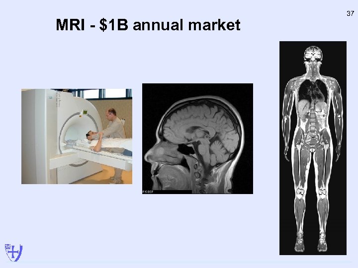 MRI - $1 B annual market 37 