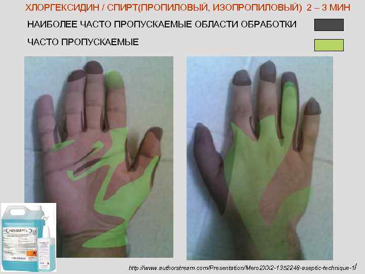 ХЛОРГЕКСИДИН / СПИРТ(ПРОПИЛОВЫЙ, ИЗОПРОПИЛОВЫЙ) 2 – 3 МИН НАИБОЛЕЕ ЧАСТО ПРОПУСКАЕМЫЕ ОБЛАСТИ ОБРАБОТКИ ЧАСТО