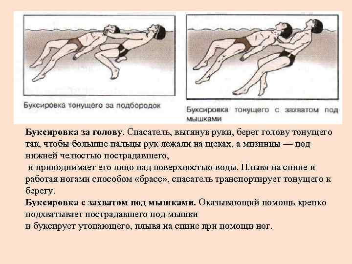 Буксировка за голову. Спасатель, вытянув руки, берет голову тонущего так, чтобы большие пальцы рук