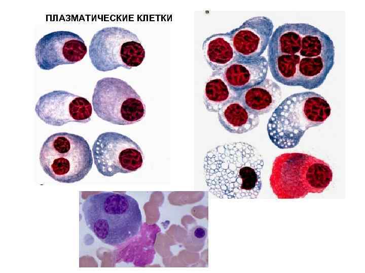 Плазматические клетки в общем анализе