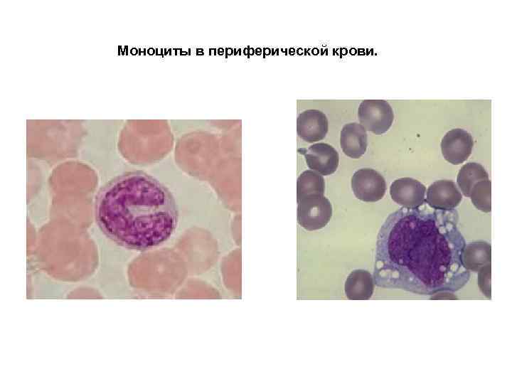 Моноциты в периферической крови. 