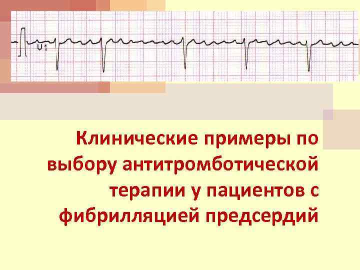 Клинические примеры по выбору антитромботической терапии у пациентов с фибрилляцией предсердий 