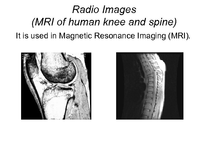 Radio Images (MRI of human knee and spine) It is used in Magnetic Resonance