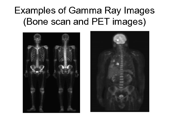 Examples of Gamma Ray Images (Bone scan and PET images) 