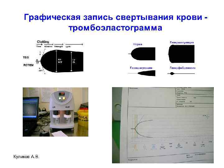 Куликов А. В. 