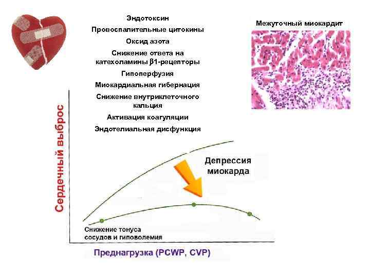 Эндотоксин Провоспалительные цитокины Оксид азота Снижение ответа на катехоламины 1 -рецепторы Гипоперфузия Миокардиальная гибернация