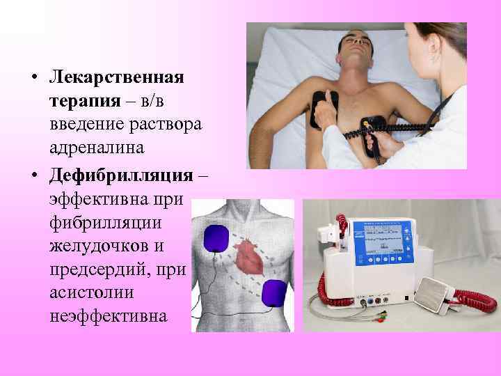  • Лекарственная терапия – в/в введение раствора адреналина • Дефибрилляция – эффективна при
