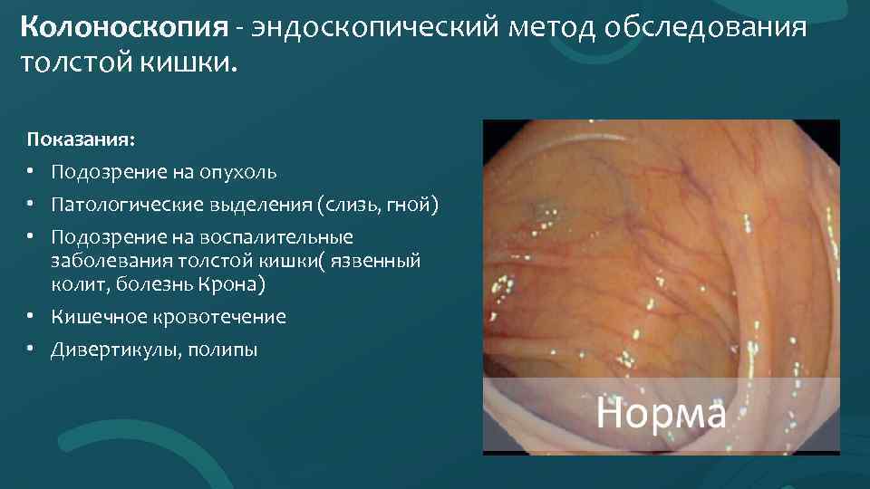 Колоноскопия - эндоскопический метод обследования толстой кишки. Показания: • Подозрение на опухоль • Патологические