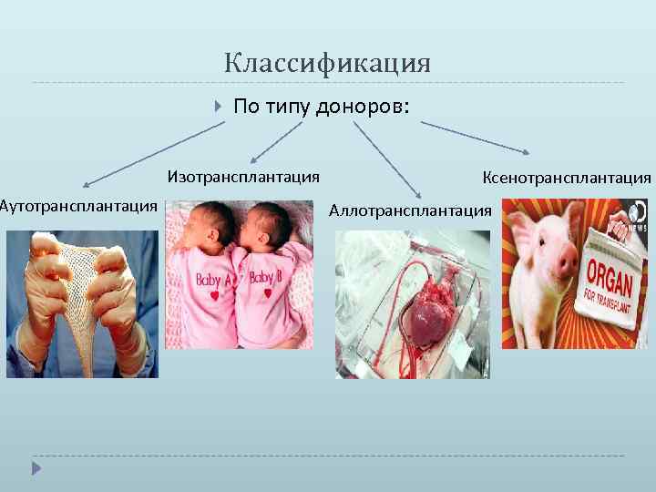 Аутотрансплантация Классификация По типу доноров: Изотрансплантация Ксенотрансплантация Аллотрансплантация 