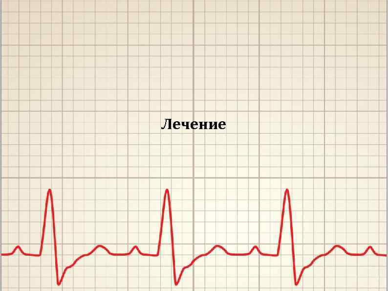 Лечение 