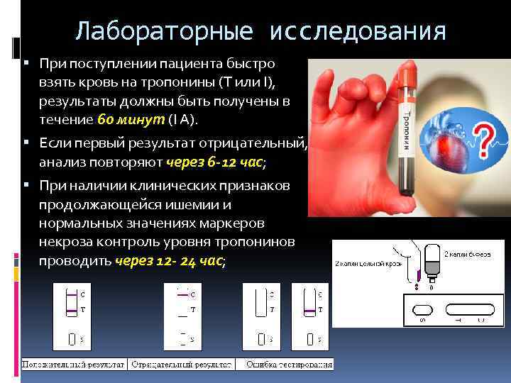 Лабораторные исследования При поступлении пациента быстро взять кровь на тропонины (T или I), результаты