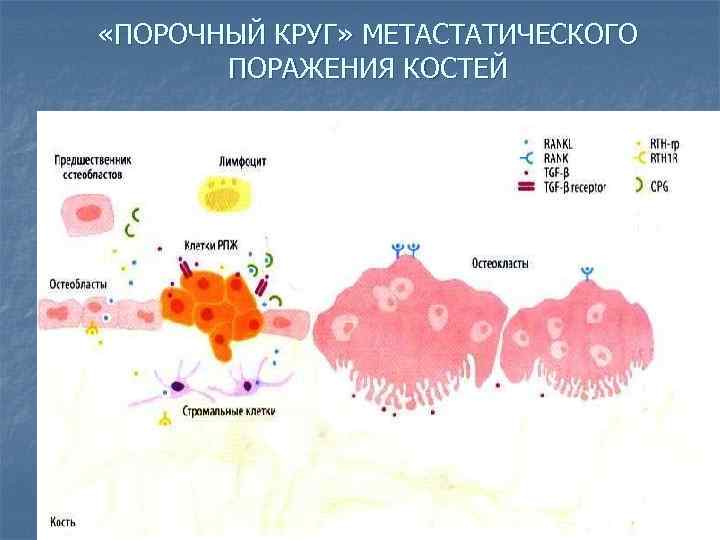  «ПОРОЧНЫЙ КРУГ» МЕТАСТАТИЧЕСКОГО ПОРАЖЕНИЯ КОСТЕЙ 