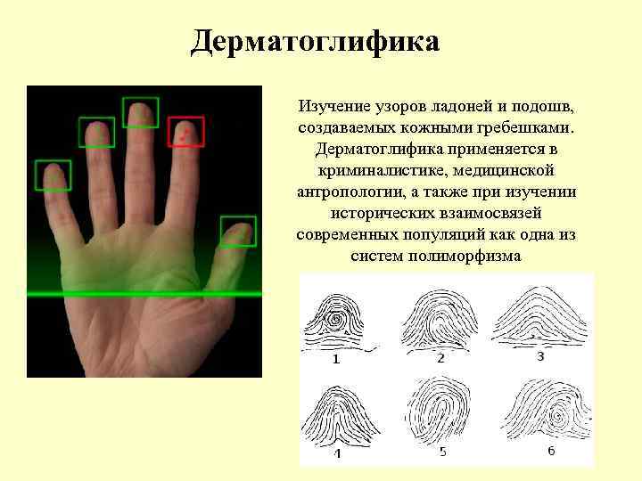 Дерматоглифический рисунок это