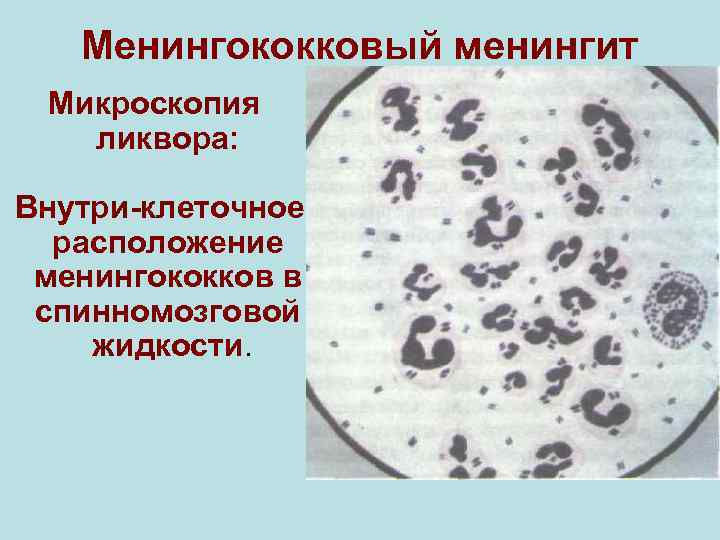 В картине ликвора при отогенном менингите