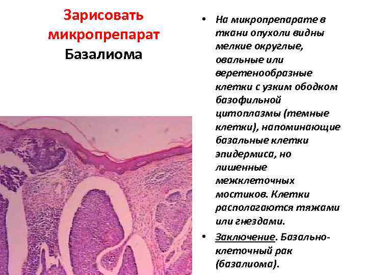 Патологическая анатомия лекции