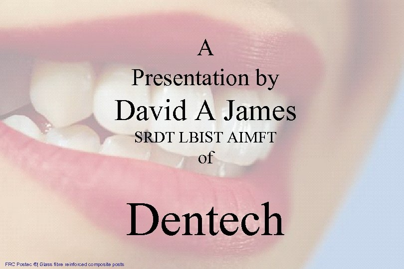 IPS Empress® System – das Original A Presentation by David A James SRDT LBIST