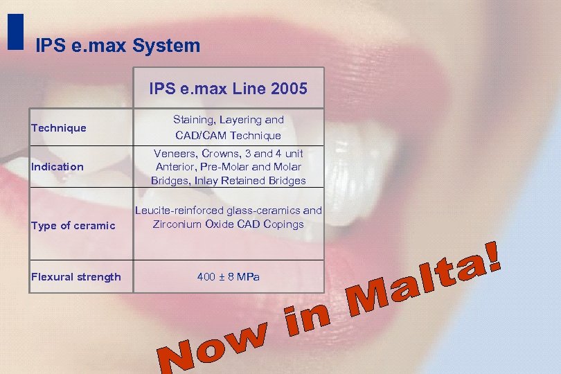 13 IPS e. max System IPS e. max Line 2005 Technique Staining, Layering and