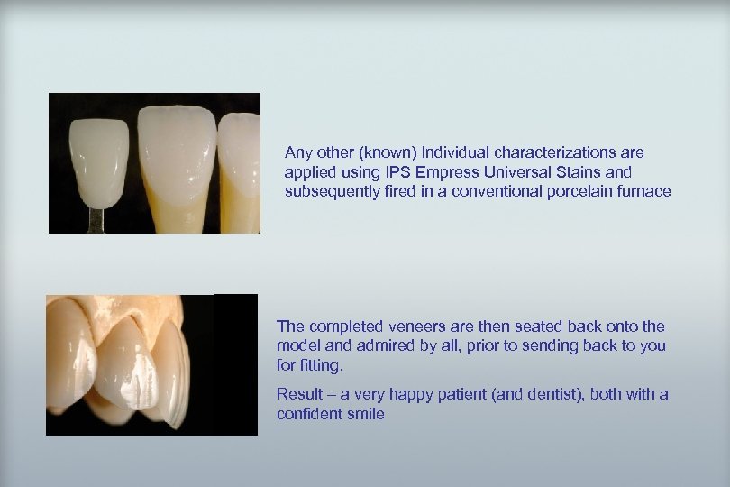 IPS 23 d. SIGN® Any other (known) Individual characterizations are applied using IPS Empress