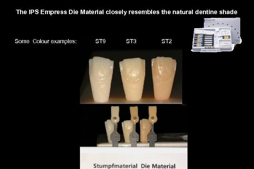 29 The IPS Empress Die Material closely resembles the natural dentine shade Some Colour