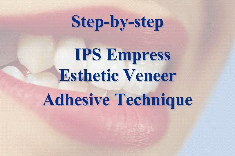 37 Step-by-step IPS Empress Esthetic Veneer Adhesive Technique The success story Shade selection /