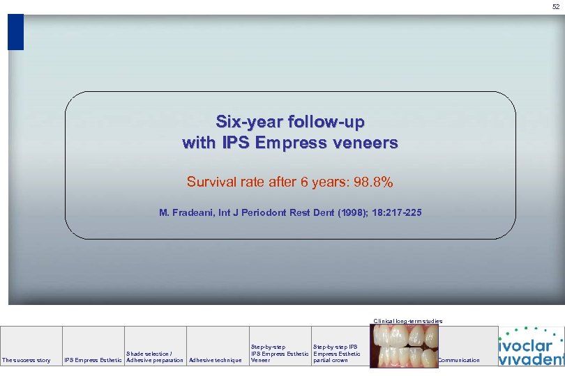 52 Six-year follow-up with IPS Empress veneers Survival rate after 6 years: 98. 8%