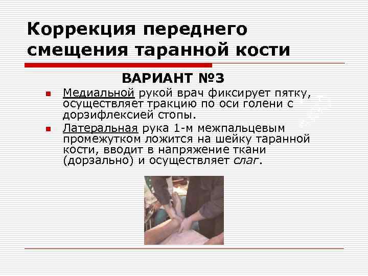 Коррекция переднего смещения таранной кости ВАРИАНТ № 3 n n Медиальной рукой врач фиксирует