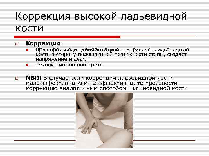 Коррекция высокой ладьевидной кости o Коррекция: n n o Врач производит декоаптацию: направляет ладьевидную