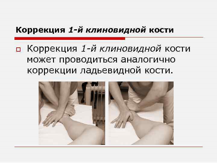 Коррекция 1 -й клиновидной кости o Коррекция 1 -й клиновидной кости может проводиться аналогично