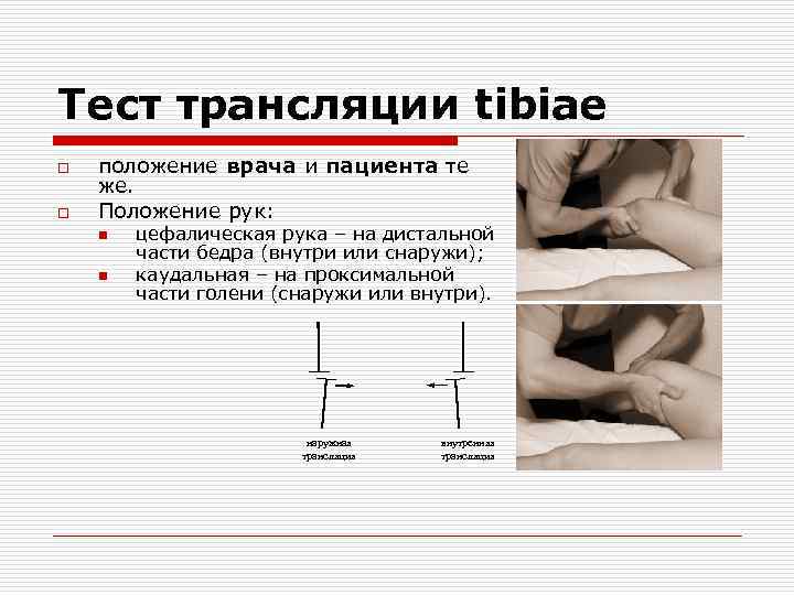 Тест трансляции tibiae o o положение врача и пациента те же. Положение рук: n