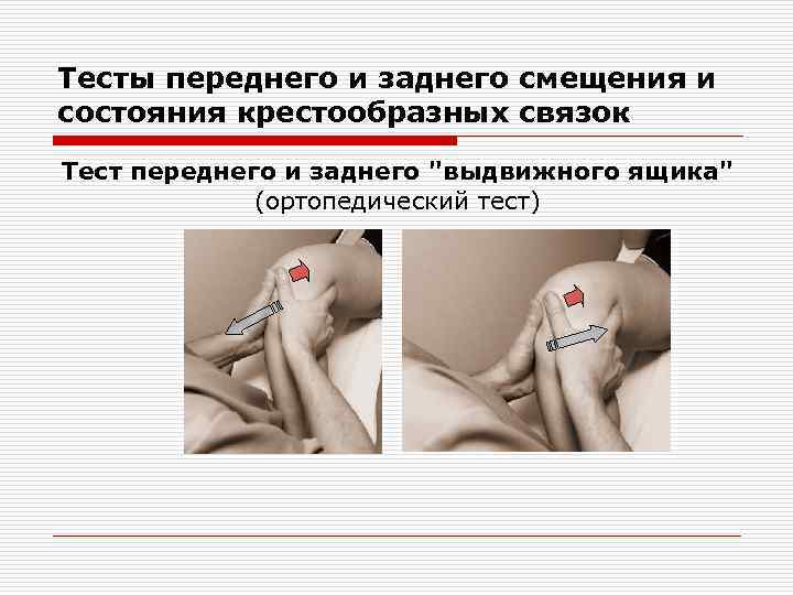 Тесты переднего и заднего смещения и состояния крестообразных связок Тест переднего и заднего 