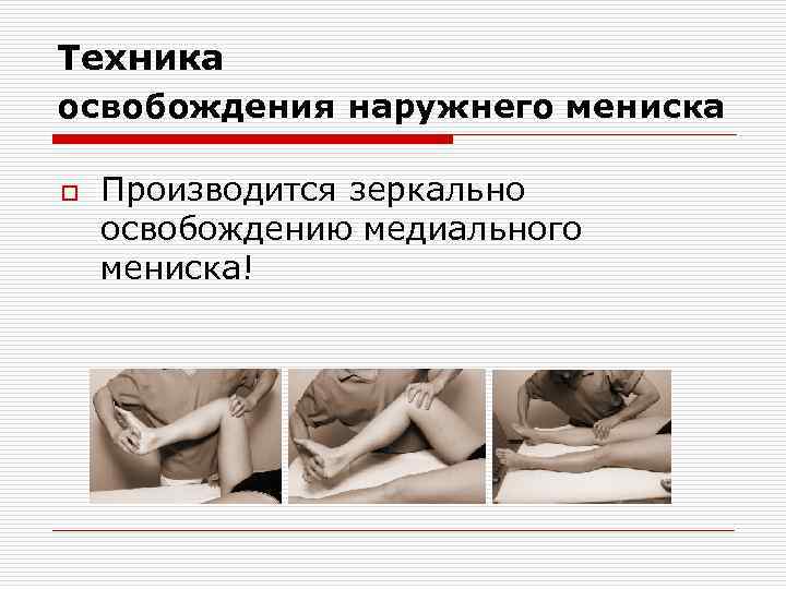 Техника освобождения наружнего мениска o Производится зеркально освобождению медиального мениска! 