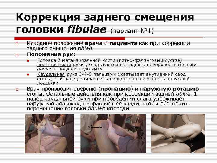 Коррекция заднего смещения головки fibulae (вариант № 1) o o Исходное положение врача и