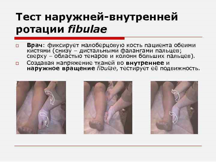 Тест наружней-внутренней ротации fibulae o o Врач: фиксирует малоберцовую кость пациента обеими кистями (снизу