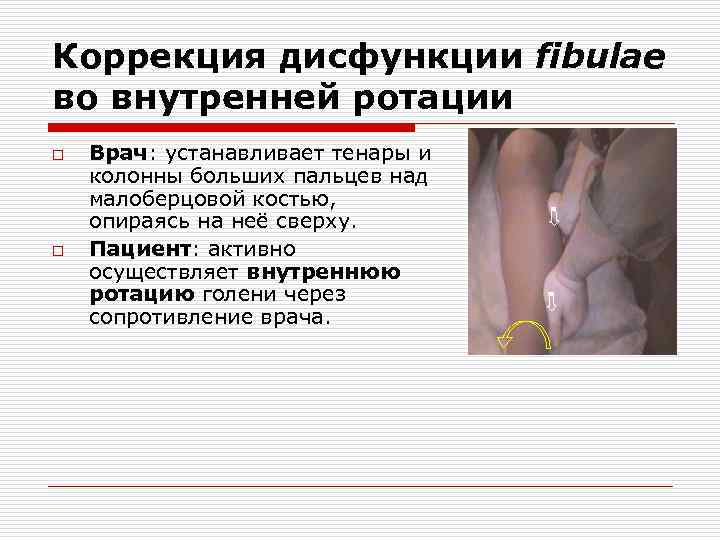 Коррекция дисфункции fibulae во внутренней ротации o o Врач: устанавливает тенары и колонны больших