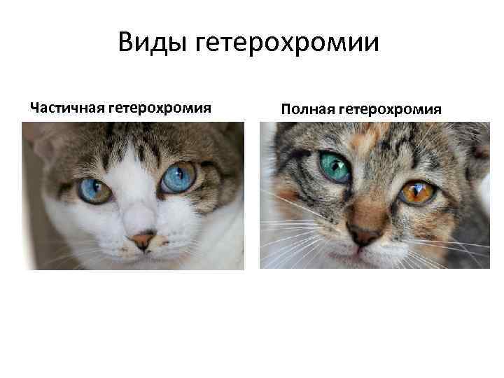 Виды гетерохромии Частичная гетерохромия Полная гетерохромия 