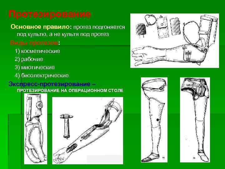 Протезирование Основное правило: протез подгоняется под культю, а не культя под протез Виды протезов: