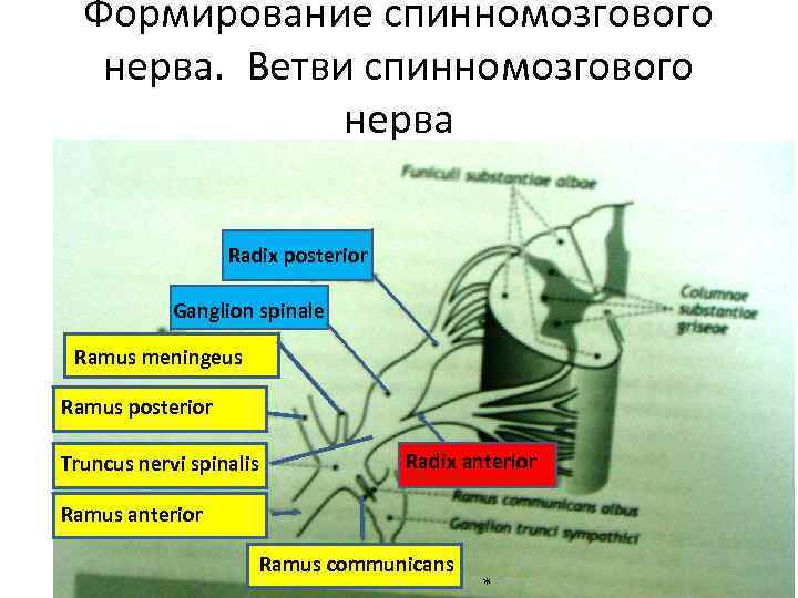 Формирование спинномозгового нерва. Ветви спинномозгового нерва Radix posterior Ganglion spinale Ramus meningeus Ramus posterior