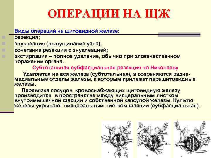 ОПЕРАЦИИ НА ЩЖ n n Виды операций на щитовидной железе: резекция; энуклеация (вылущивание узла);