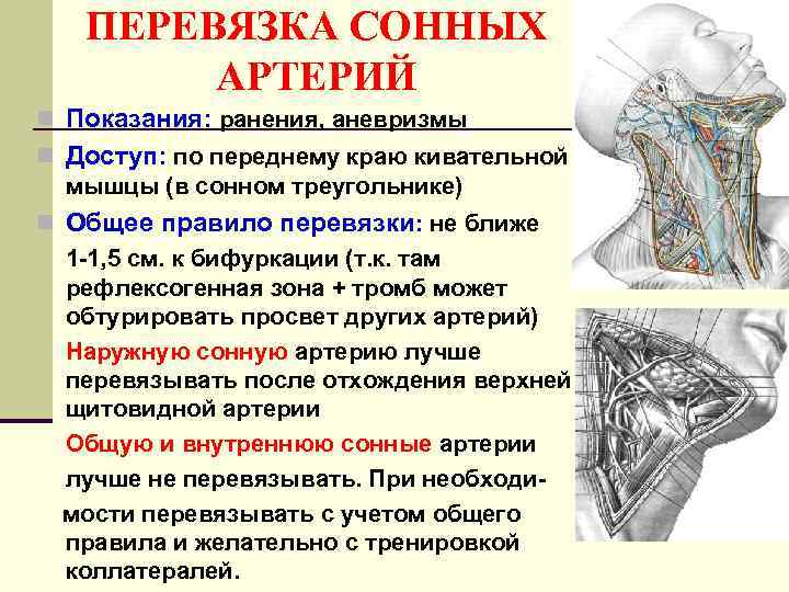 ПЕРЕВЯЗКА СОННЫХ АРТЕРИЙ n Показания: ранения, аневризмы n Доступ: по переднему краю кивательной мышцы