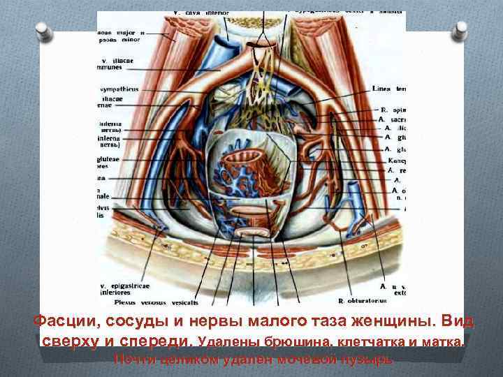 Фасции, сосуды и нервы малого таза женщины. Вид сверху и спереди. Удалены брюшина, клетчатка